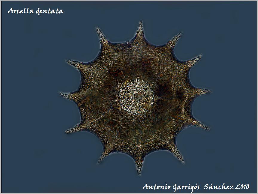 Arcella dentata 2